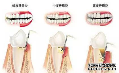 敌袭!警惕偷走牙齿的头号敌人!!